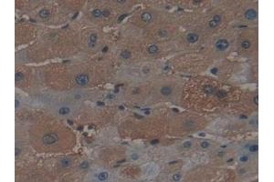 Detection of FTH in Human Liver Tissue using Polyclonal Antibody to Ferritin, Heavy Polypeptide (FTH) (FTH1 antibody  (AA 1-183))