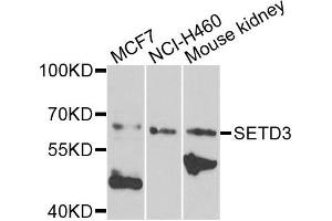 Western blot analysis of extracts of various cells, using SETD3 antibody. (SETD3 antibody)
