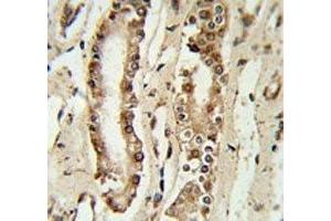 FOXP1 antibody IHC analysis in formalin fixed and paraffin embedded lung tissue. (FOXP1 antibody  (AA 650-677))