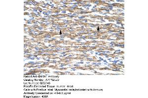Human Heart (BARX1 antibody  (Middle Region))
