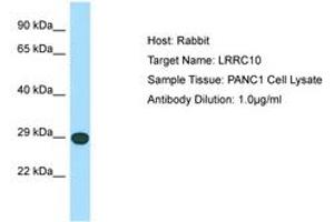 Image no. 1 for anti-Leucine Rich Repeat Containing 10 (LRRC10) (C-Term) antibody (ABIN6750054) (LRRC10 antibody  (C-Term))