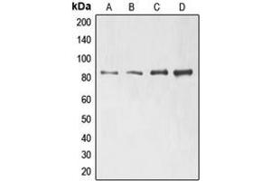 Western blot analysis of ELMO1 expression in Jurkat (A), H1299 (B), HeLa (C), HL60 (D) whole cell lysates. (ELMO1 antibody  (N-Term))