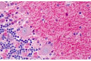 Human Brain, Cerebellum: Formalin-Fixed, Paraffin-Embedded (FFPE) (DLG4 antibody  (C-Term))