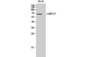 Western Blotting (WB) image for anti-Calcium/calmodulin-Dependent Protein Kinase II beta (CAMK2B) (Internal Region) antibody (ABIN3180521) (CAMK2B antibody  (Internal Region))