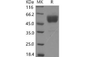 Western Blotting (WB) image for CD69 (CD69) protein (Fc Tag,ECD) (ABIN7320166) (CD69 Protein (CD69) (Fc Tag,ECD))