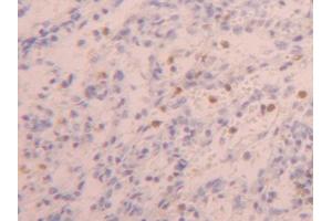 DAB staining on IHC-P; Samples: Human Spleen Tissue (ZYX antibody  (AA 384-572))
