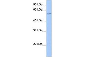 DNTT antibody used at 1 ug/ml to detect target protein. (TdT antibody  (N-Term))