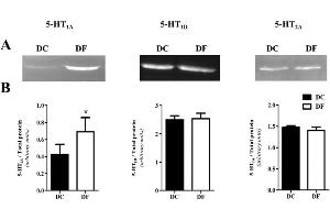 5-HT1A/1D/2A receptor expression in thoracic aortas from control (DC) and fluoxetine-treated (DF) diabetic rats by Western blot.