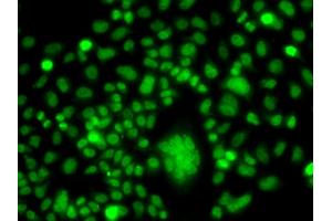 Immunofluorescence analysis of A549 cells using PPAN antibody (ABIN5975126). (PPAN antibody)
