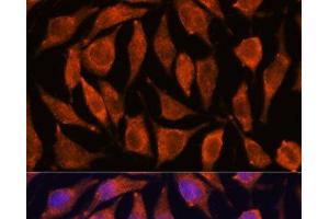 Immunofluorescence analysis of L929 cells using TNFAIP8L2 Polyclonal Antibody at dilution of 1:100. (TNFAIP8L2 antibody)