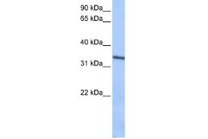 Septin 9 antibody used at 0.