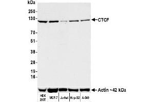 Western Blotting (WB) image for anti-CCCTC-Binding Factor (Zinc Finger Protein) (CTCF) (AA 650-700) antibody (ABIN7453967)