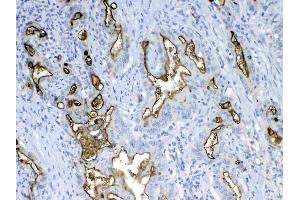Immunohistochemistry (IHC) image for anti-Mucin 1 (MUC1) (AA 1062-1139) antibody (ABIN5693192)