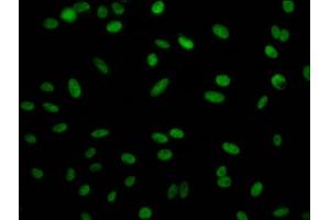 Immunofluorescence staining of Hela Cells with ABIN7127789 at 1:50, counter-stained with DAPI. (Recombinant Retinoblastoma Binding Protein 4 antibody)