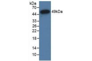Detection of Recombinant GR, Human using Polyclonal Antibody to Glucocorticoid Receptor (GR) (Glucocorticoid Receptor antibody  (AA 598-755))