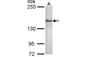 WB Image Sample (30 ug of whole cell lysate) A: 293T 5% SDS PAGE antibody diluted at 1:1000 (CACNA1S antibody  (Center))