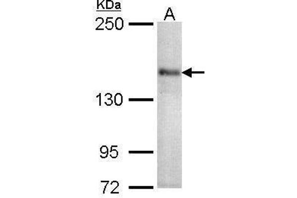 CACNA1S anticorps  (Center)