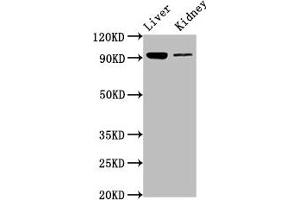 Western Blot Positive WB detected in: Mouse liver tissue, Mouse kidney tissue All lanes: DMGDH antibody at 6. (DMGDH antibody  (AA 429-524))