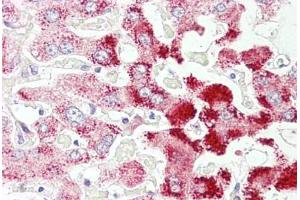 Anti-SCP2 antibody IHC staining of human liver. (SCP2 antibody  (AA 163-175))