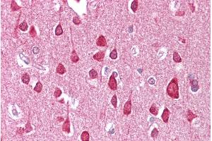 Brain, cortex (SLC18A1 antibody  (Middle Region))