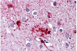 Brain, cortex, Human: Formalin-Fixed, Paraffin-Embedded (FFPE) (DDX58 antibody)