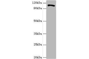 Western blot All lanes: HIP1 antibody at 4 μg/mL + A549 whole cell lysate Secondary Goat polyclonal to rabbit IgG at 1/10000 dilution Predicted band size: 117, 111, 114 kDa Observed band size: 117 kDa (HIP1 antibody  (AA 410-690))