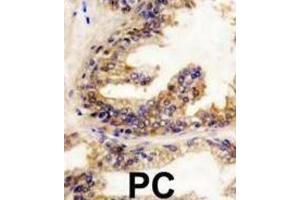 Immunohistochemistry (IHC) image for anti-Small Nuclear Ribonucleoprotein Polypeptide E (SNRPE) antibody (ABIN3003507) (SNRPE antibody)