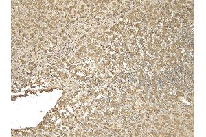 Immunohistochemistry (IHC) image for anti-Solute Carrier Family 18 (Vesicular Monoamine Transporter), Member 2 (SLC18A2) (C-Term) antibody (ABIN570915)