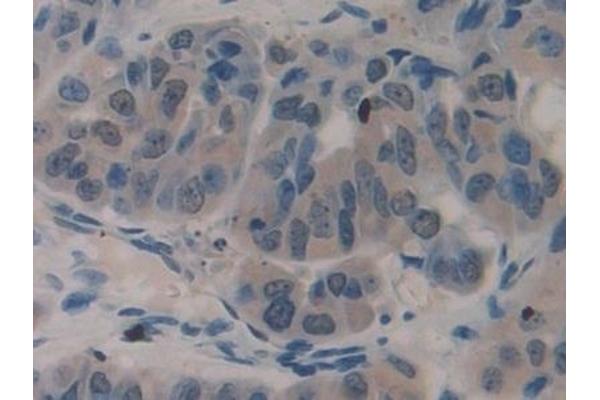 TMPRSS4 antibody  (AA 54-437)