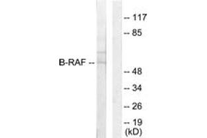 Western blot analysis of extracts from HeLa cells, using B-RAF Antibody.
