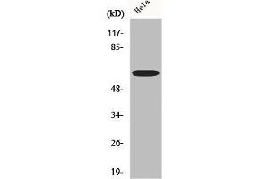 Western Blot analysis of Hela cells using AATF Polyclonal Antibody (AATF antibody  (N-Term))