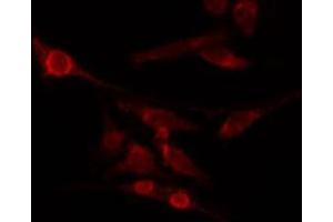 ABIN6274032 staining HepG2 by IF/ICC. (HSF1 antibody  (pSer326))