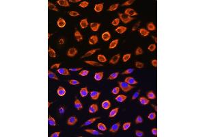 Immunofluorescence analysis of L929 cells using RND1 Rabbit pAb (ABIN6128639, ABIN6146997, ABIN6146998 and ABIN6217798) at dilution of 1:100. (RND1 antibody  (AA 103-232))