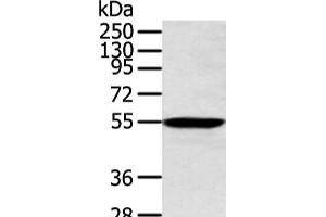 Western blot analysis of Human lung cancer tissue using ALDH2 Polyclonal Antibody at dilution of 1:300 (ALDH2 antibody)