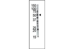 The anti-GCNT1 Pab (ABIN389033 and ABIN2839248) is used in Western blot to detect GCNT1 in mouse kidney tissue lysate. (GCNT1 antibody  (AA 88-117))