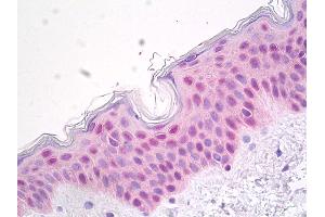 Anti-HSPA1A / HSP72 antibody IHC of human skin.