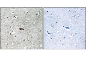 Immunohistochemistry analysis of paraffin-embedded human brain tissue, using PKC delta (Ab-645) Antibody. (PKC delta antibody  (AA 612-661))