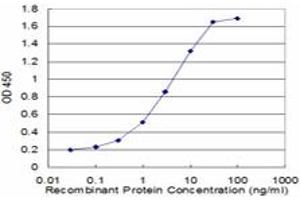 Detection limit for recombinant GST tagged TROVE2 is approximately 0. (TROVE2 antibody  (AA 1-538))