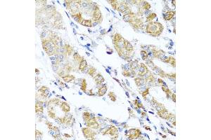 Immunohistochemistry of paraffin-embedded human stomach using D antibody (ABIN6127461, ABIN6139409, ABIN6139410 and ABIN6223779) at dilution of 1:100 (40x lens). (DARS2 antibody  (AA 406-645))