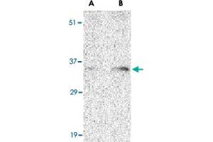 Western blot analysis of BAG1 in PC-3 cell lysate with BAG1 polyclonal antibody  at (A) 1 and (B) 2 ug/mL .