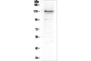 Western blot analysis of Integrin alpha 3 using anti-Integrin alpha 3 antibody (ABIN6719410). (ITGA3 antibody)