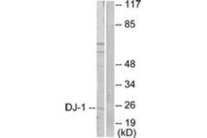 Western blot analysis of extracts from HuvEc cells, using DJ-1 Antibody. (PARK7/DJ1 antibody  (AA 21-70))
