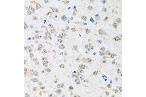 Immunohistochemistry of paraffin-embedded mouse brain using RPLP1 antibody at dilution of 1:100 (x40 lens). (RPLP1 antibody)