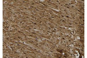 ABIN6277093 at 1/100 staining Rat heart tissue by IHC-P. (PKC epsilon antibody  (C-Term))