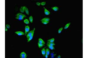 Immunofluorescent analysis of HepG2 cells using ABIN7167064 at dilution of 1:100 and Alexa Fluor 488-congugated AffiniPure Goat Anti-Rabbit IgG(H+L) (RFTN2 antibody  (AA 1-300))