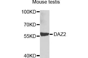 Western blot analysis of extracts of mouse testis, using DAZ2 antibody.