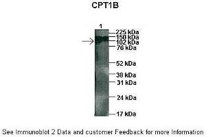 Sample Type :  1: 45ug human capan1 cell lysate  Primary Antibody Dilution :  1:1000  Secondary Antibody :  Anti-rabbit HRP  Secondary Antibody Dilution :  1:5000  Color/Signal Descriptions :  ARP46444-QC16367-WB-image-02  Gene Name :  CPT1B  Submitted by :  Dr. (CPT1B antibody  (Middle Region))