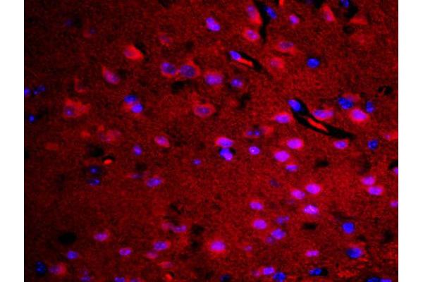 RASAL1 antibody  (AA 451-550)