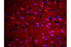 Formalin-fixed and paraffin embedded rat brain labeled with Rabbit Anti-RASAL1 Polyclonal Antibody, Unconjugated (ABIN762251) at 1:200 followed by conjugation to the secondary antibody Goat Anti-Rabbit IgG, Cy3 conjugated used at 1:200 dilution for 40 minutes at 37°C. (RASAL1 antibody  (AA 451-550))