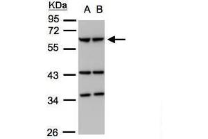 WB Image Sample (30μg whole cell lysate) A:293T B:A431, 7. (Coronin 1a antibody  (C-Term))